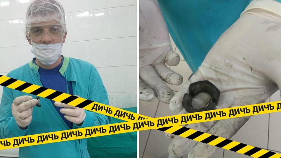 Парень надел гайку на пенис и обратился за помощью к медикам Парень надел гайку на пенис и обратился за помощью к медикам