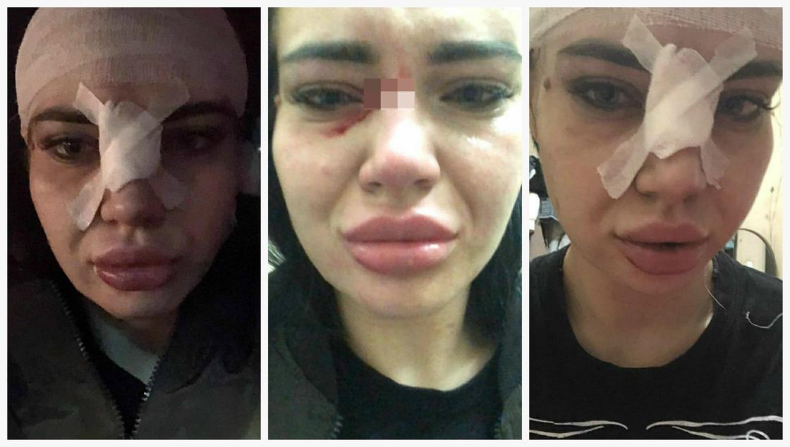 Прожектор рухнул на девушек в Караганде: стали известны подробности ЧП Прожектор рухнул на девушек в Караганде: стали известны подробности ЧП