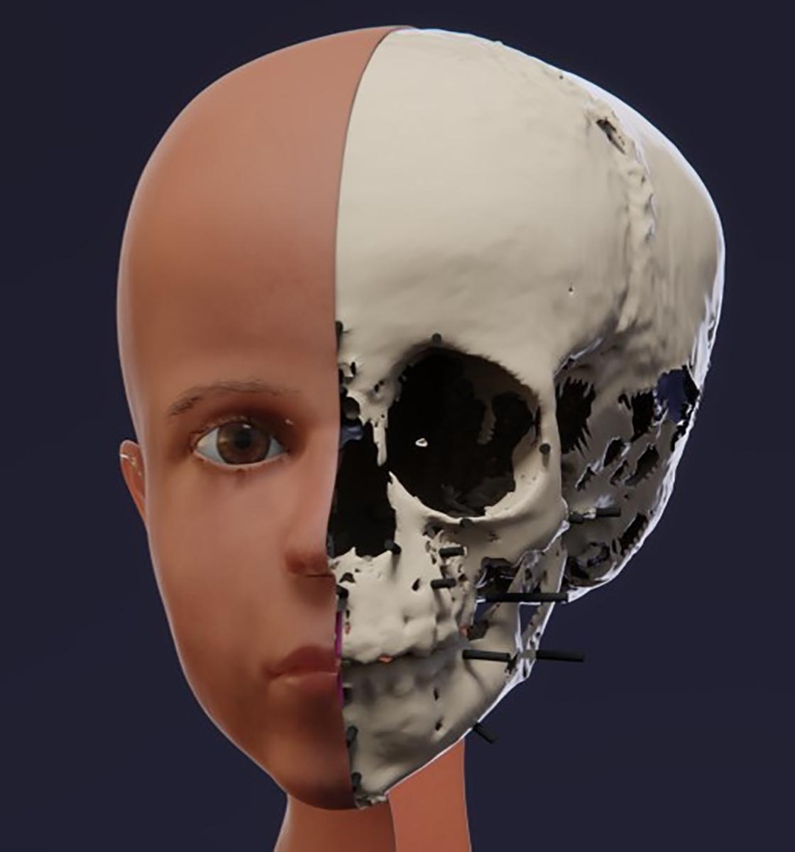 Реконструкция лица