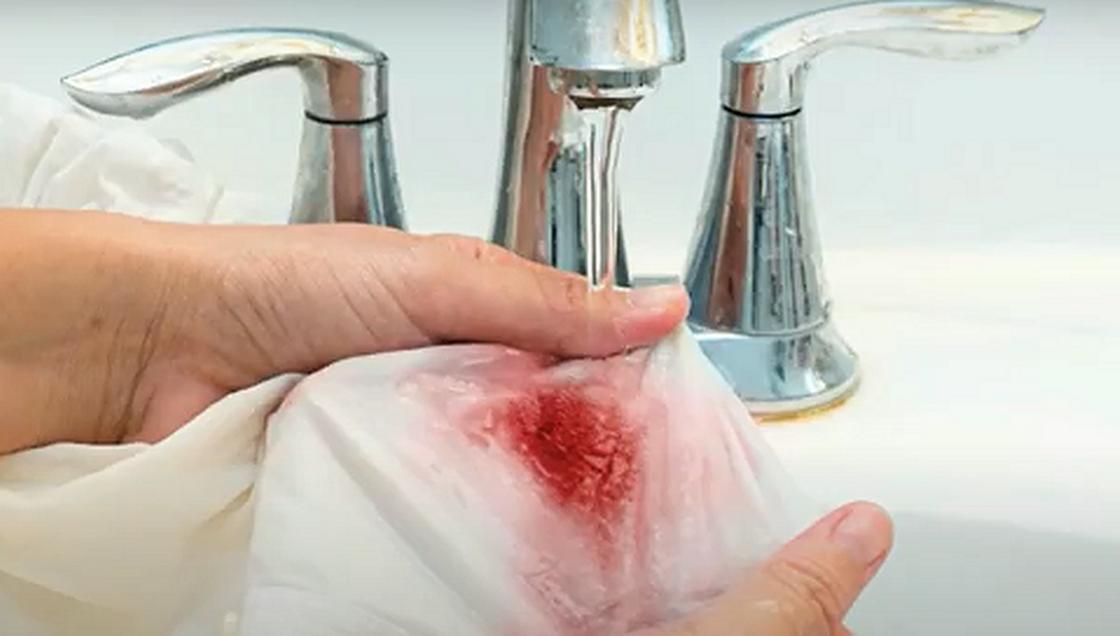 Удаление крови с ткани холодной водой