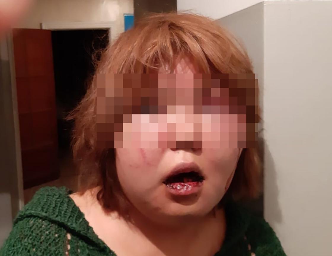 Жительница Алматинской области обвинила мужа в избиении и попытке убийства