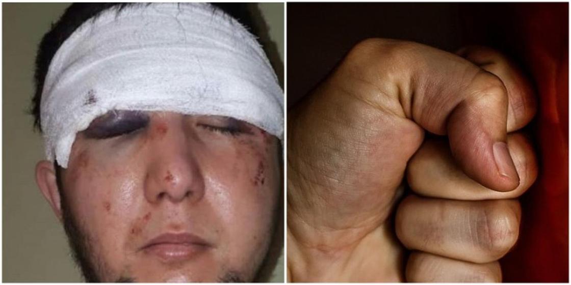 Житель Караганды обвинил спортсмена в жестоком избиении
