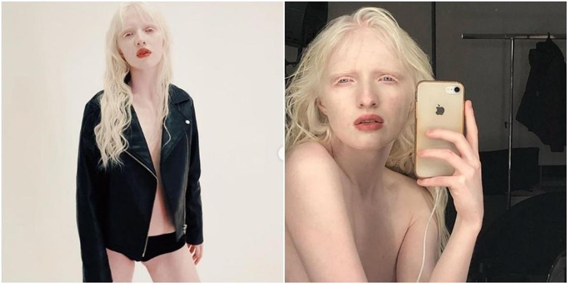 Naked Albino White Girls