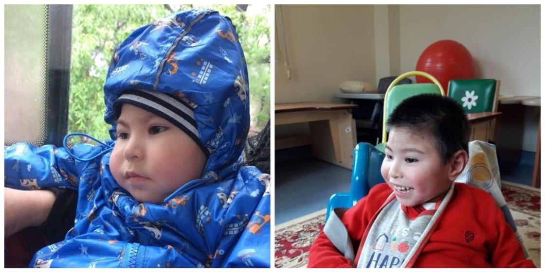 Трехлетний малыш из Усть-Каменогорска не видит и не может сидеть