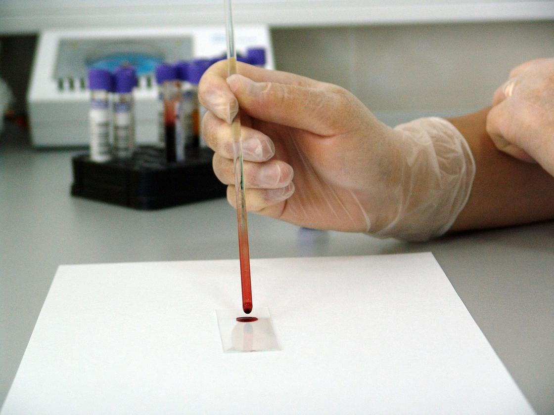 19 постояльцев дома престарелых заразились коронавирусом в Акмолинской области