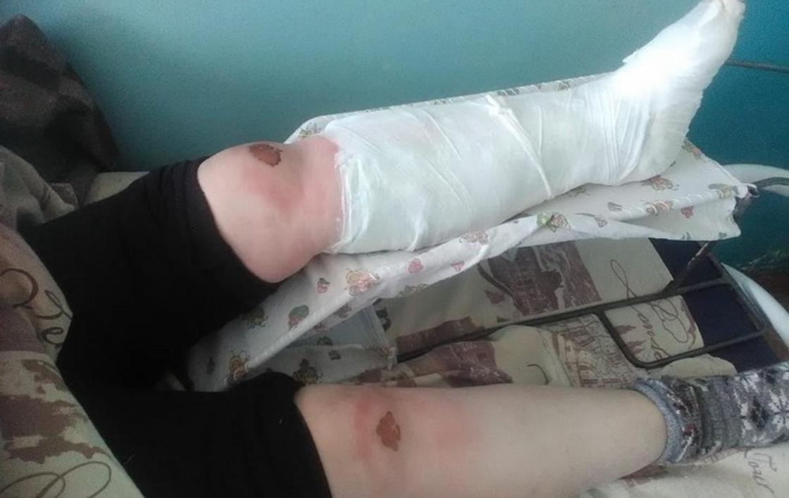 Женщина шесть километров ползла до дома со сломанной ногой в России