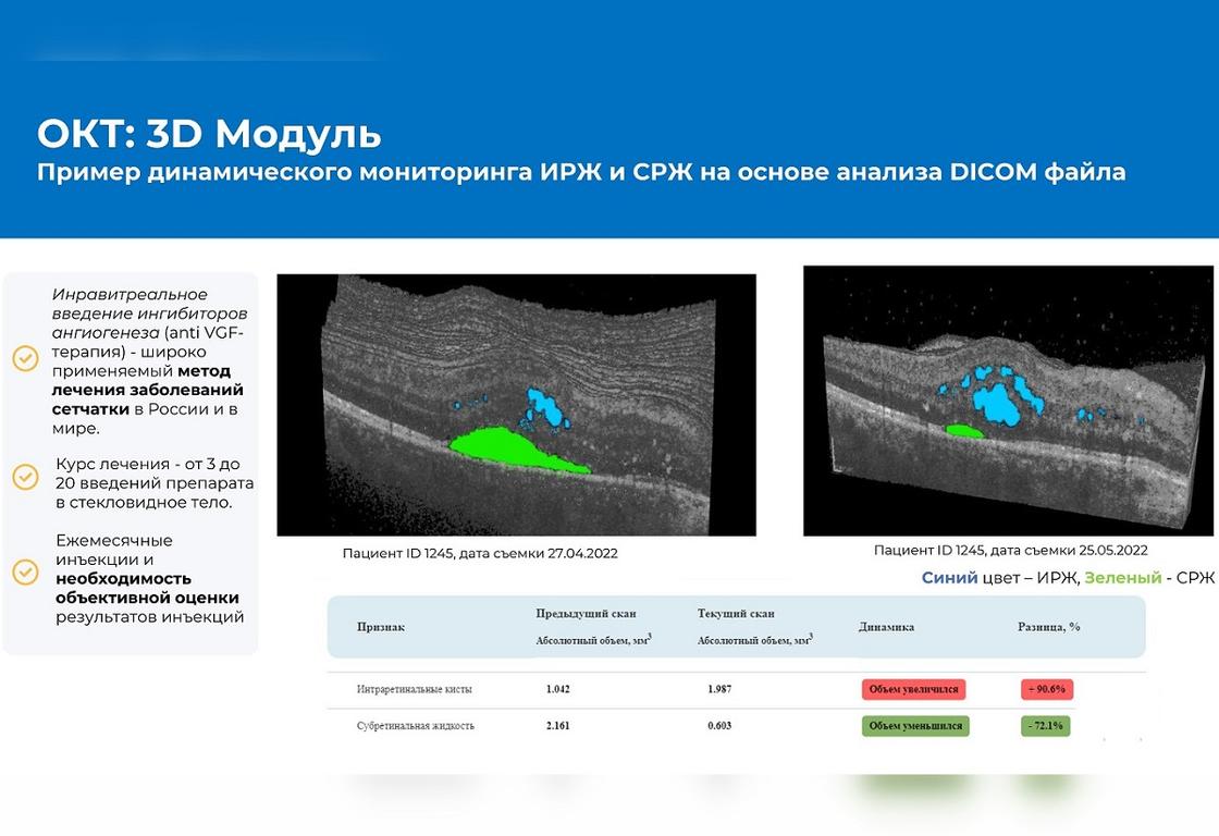 Пример динамического мониторинга ИРЖ и СРЖ на основе анализа DICOM файла