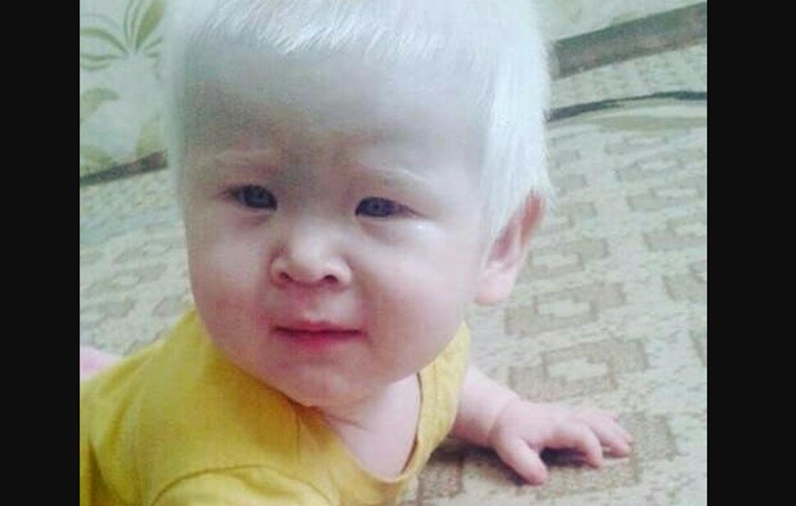 Девочка-альбинос из Уральска