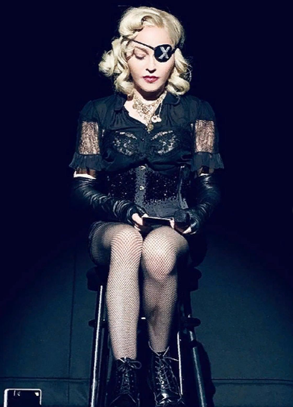 Мадонна дает концерты с травмой ноги