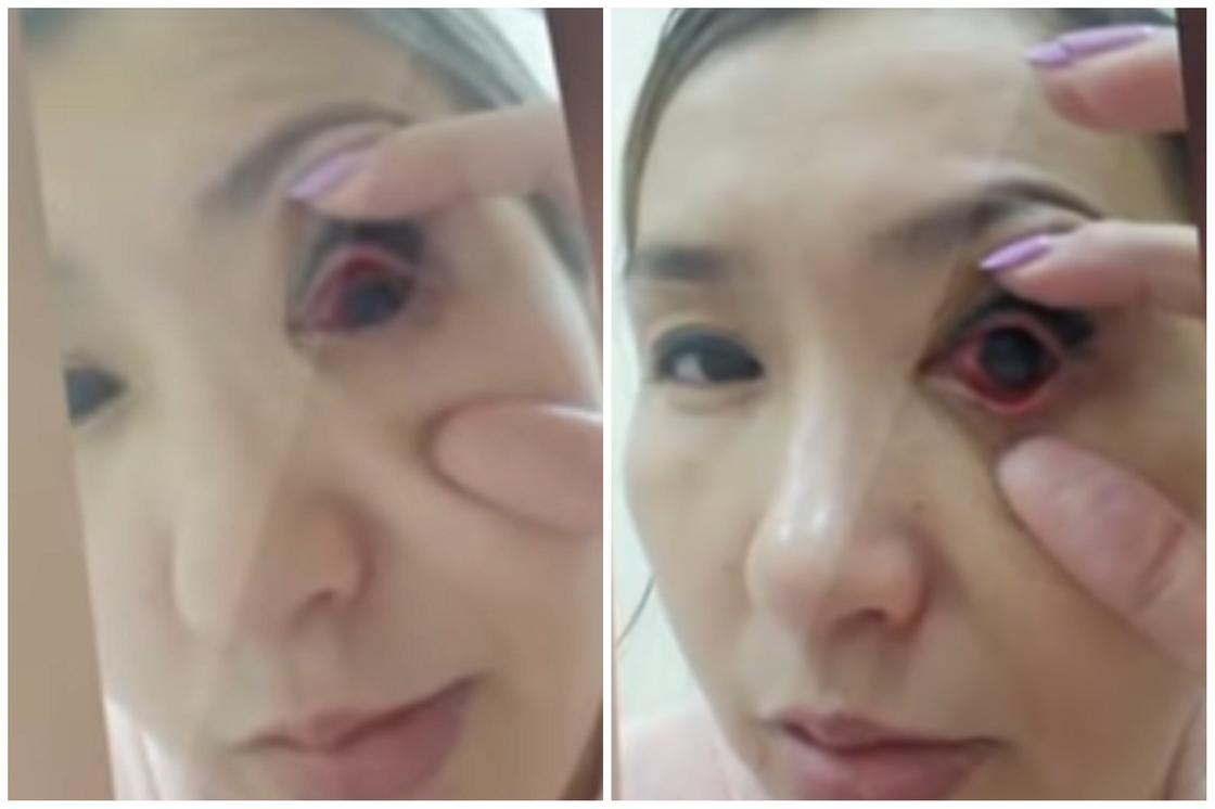 Женщина чуть не лишилась зрения после похода в салон красоты в Туркестанской области