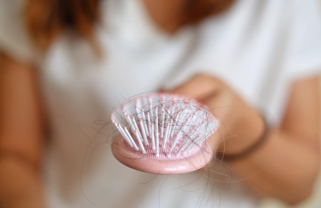 Коронавирус может спровоцировать выпадение волос