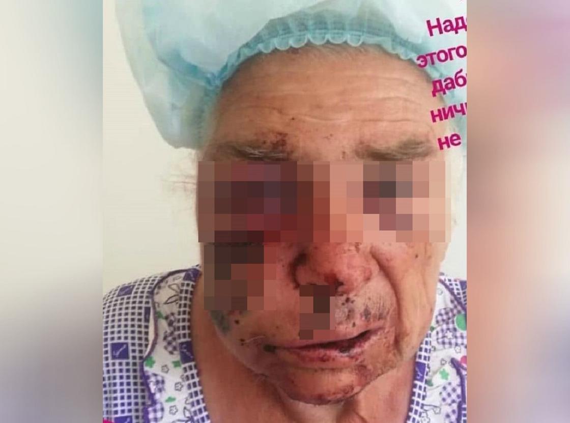 Жестоко избитая в Алматинской области бабушка заявляет, что упала