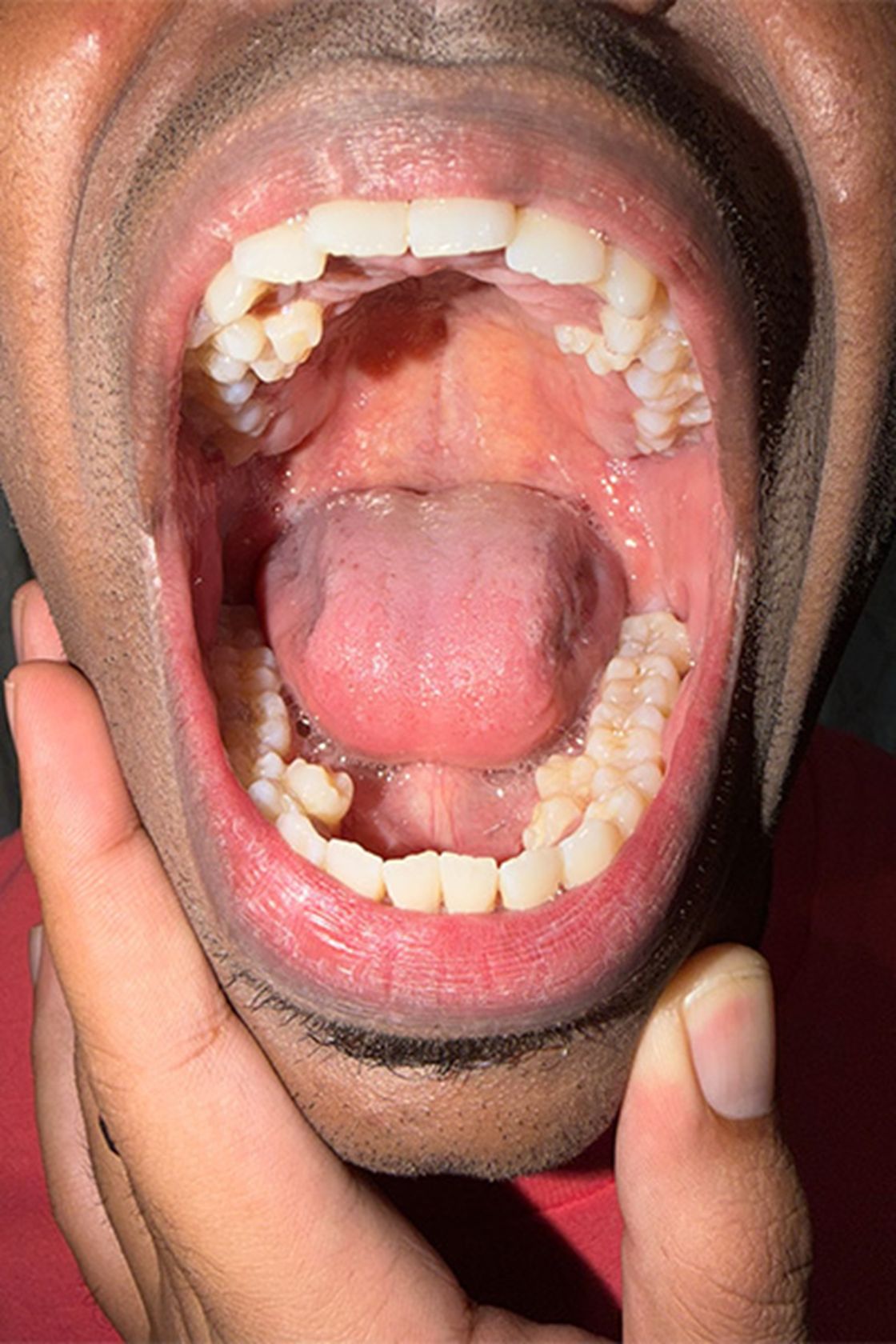 Аузындағы тіс санынан рекорд орнатқан азамат