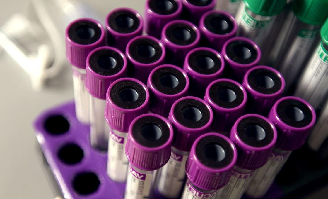 Экспресс-тесты показали ложный коронавирус у 30-ти астанчан