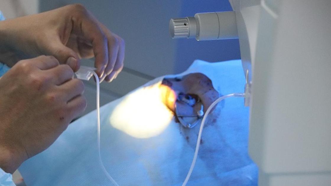 Первую лазерную операцию по коррекции кератоконуса провели в Казахстане