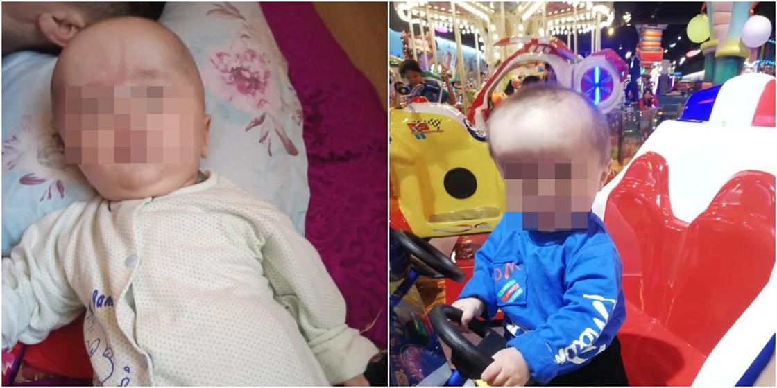 Живущие во времянке казахстанцы ищут денег на ортопедический шлем для сына с энцефалопатией