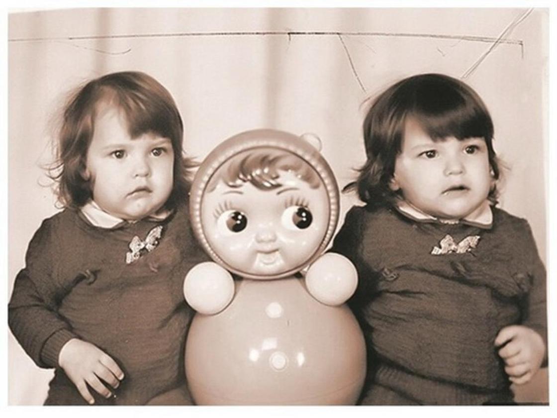 ФОТОРЕП Один живот на двоих: как живут удачно разделенные в СССР сиамские близнецы (фото)
