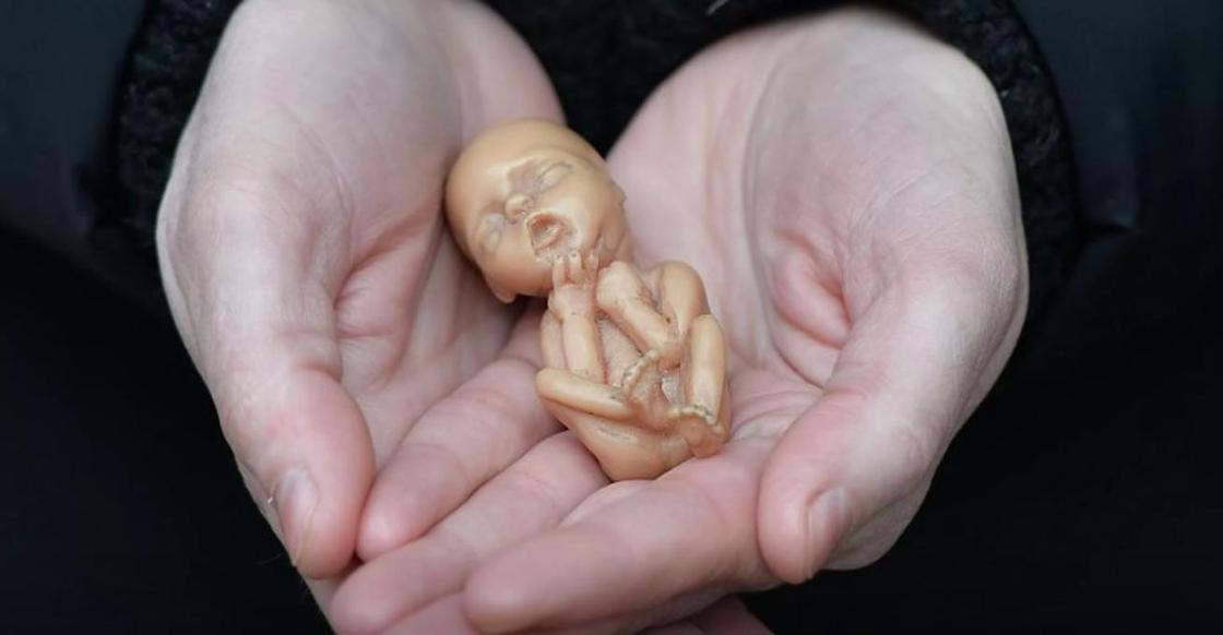 Чаще всего аборты в Казахстане делают женщины из Астаны и СКО
