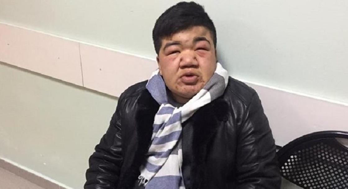 Знаменитого клоуна Кроху жестоко избили в общежитии в Алматы