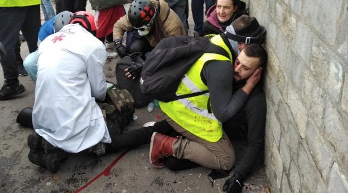 Протесты во Франции: одному из «желтых жилетов» гранатой оторвало кисть руки