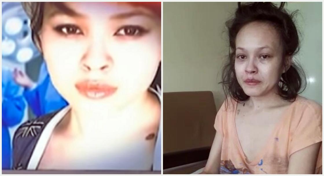 22-летняя девушка прикована к постели из-за ошибочного диагноза в Шымкенте