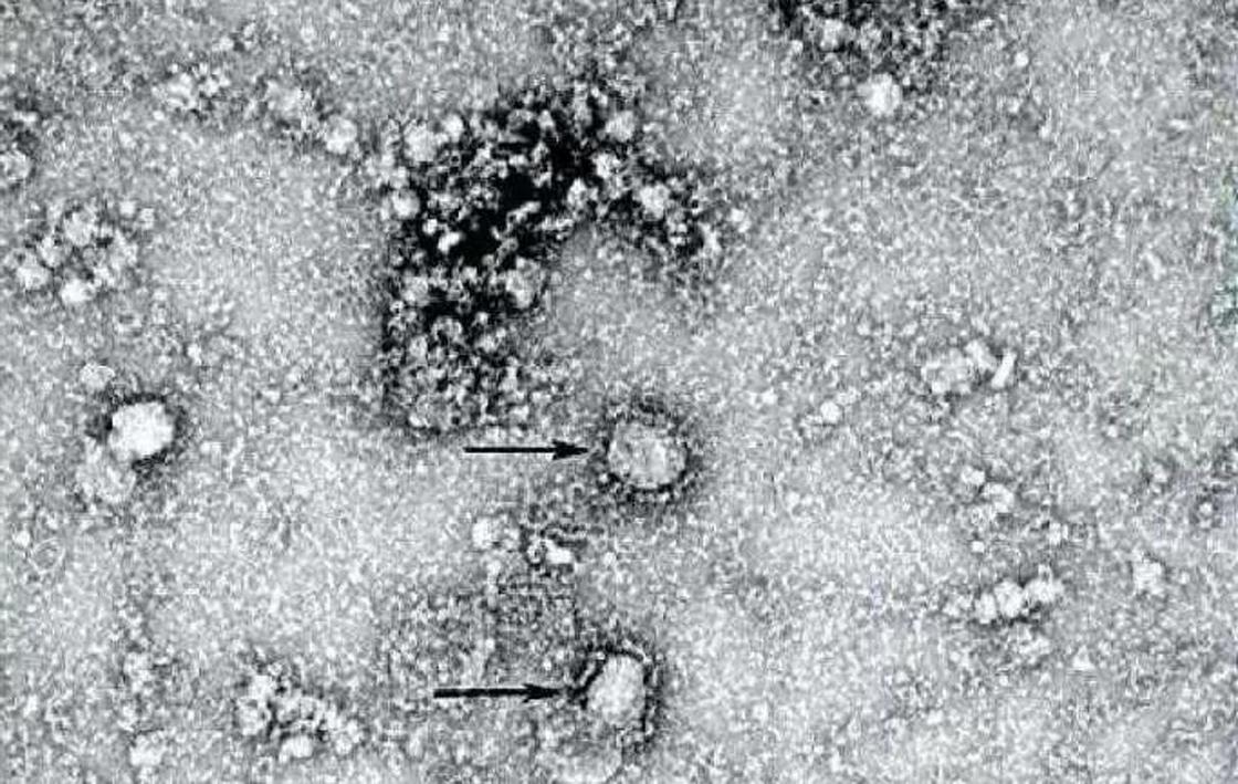 Жаңа коронавирустың микроскоп көмегімен жасалған суреті. Фото: The Chinese disease prevention authority