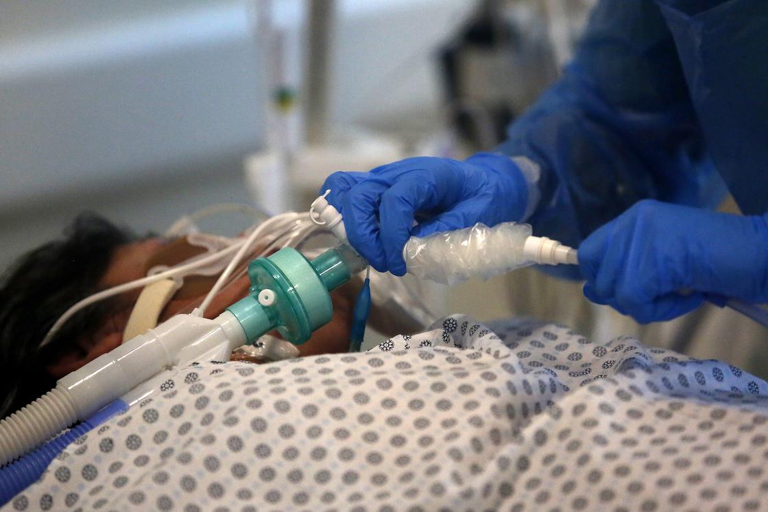Пациента со 100-процентным поражением легких спасли в одной из больниц Алматы