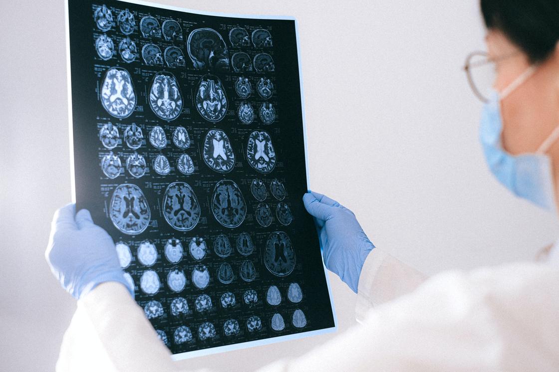 Женщина в перчатках, маске и белом халате держит в руках снимок МРТ мозга
