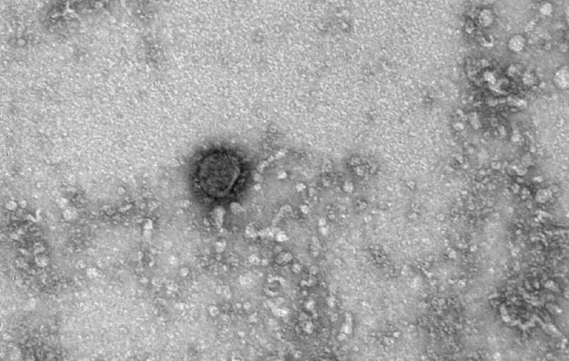 Впервые опубликованы фотографии коронавируса SARS-CoV-2