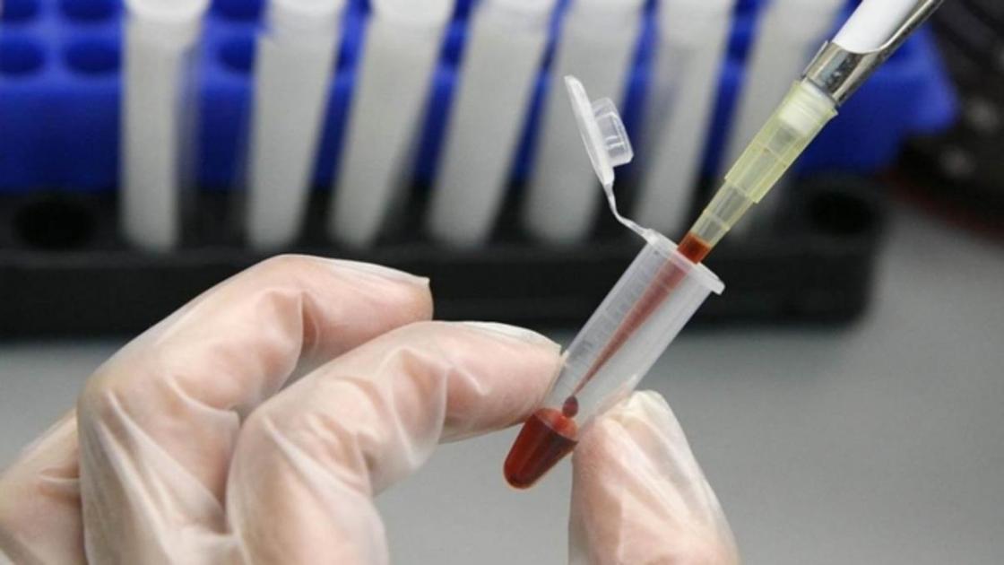 Почему важно проходить тестирование на ВИЧ?