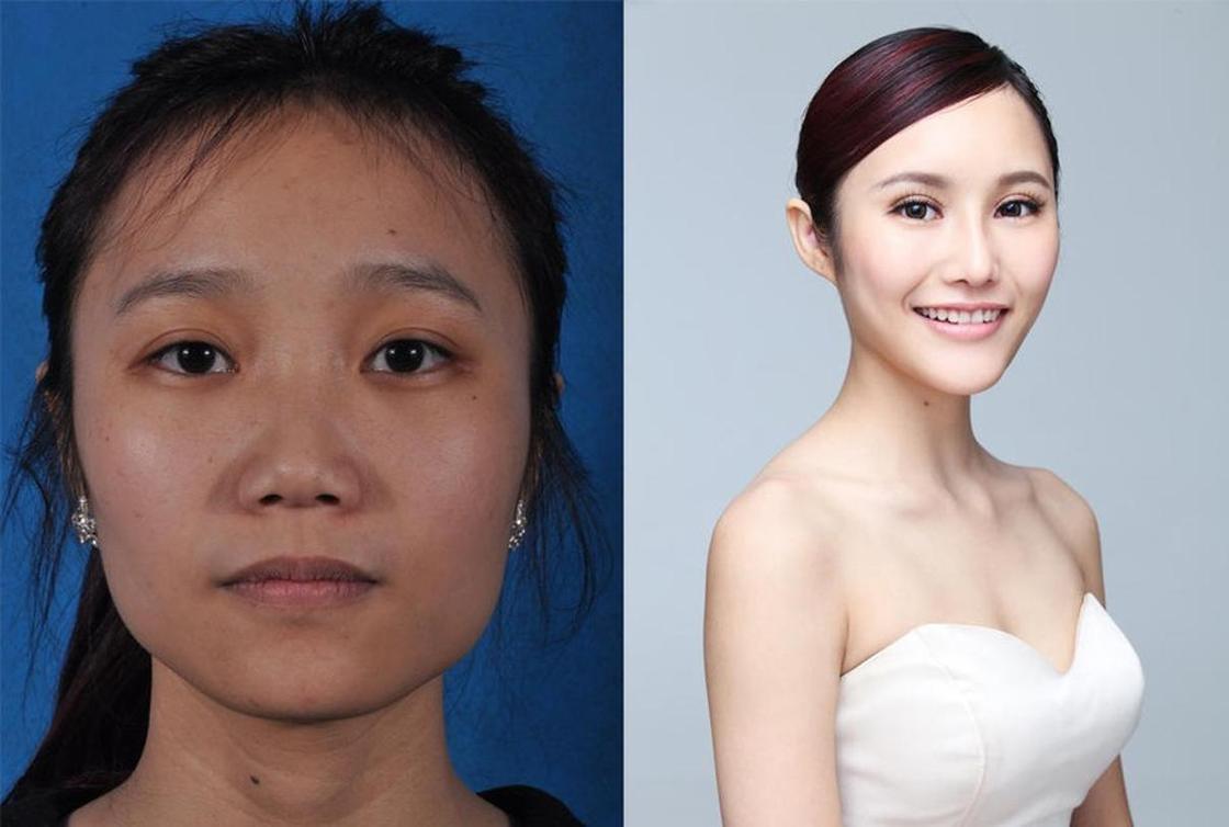 Стандарты красоты: китаянки после пластики