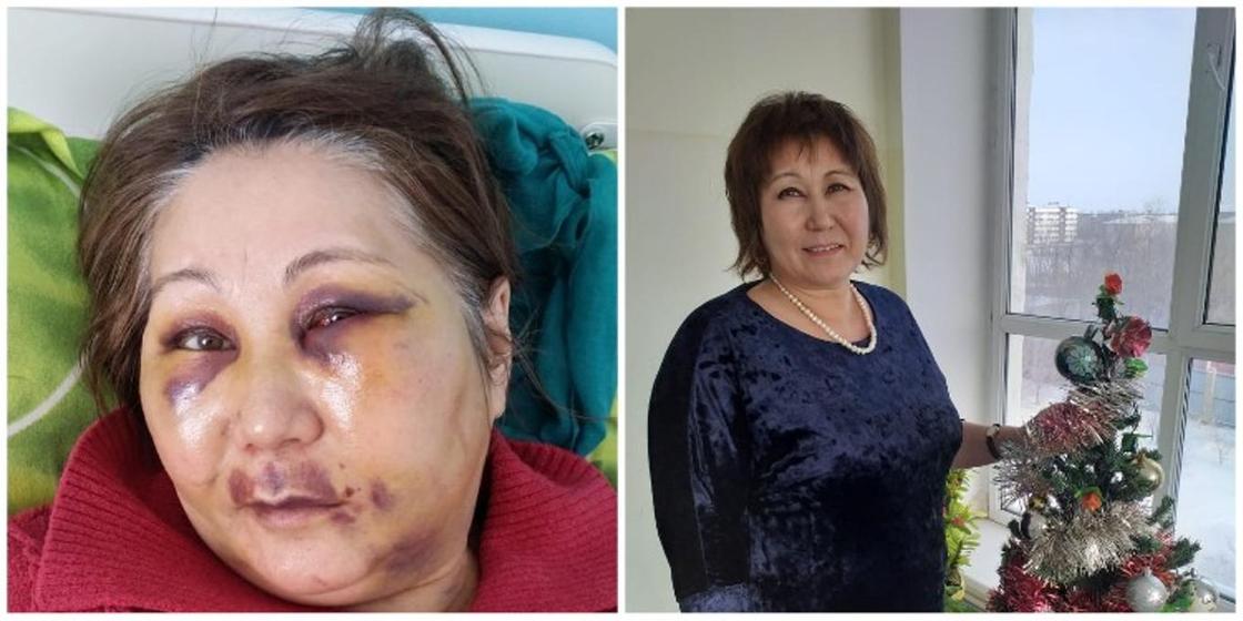 Медсестру тубдиспансера жестоко избили в Сатпаеве