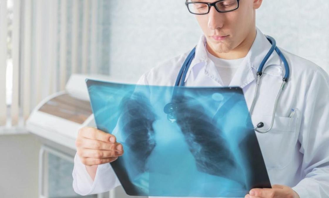 «Случаи заболевания туберкулезом под контролем»: ДООЗ Астаны