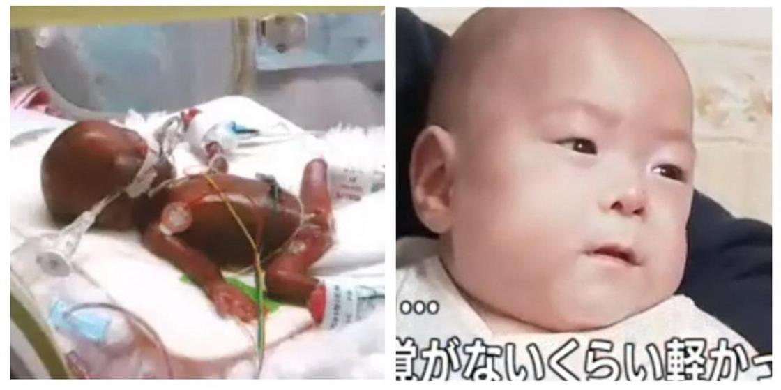 Ребенка, родившегося с весом 258 грамм, выпишут из Японской больницы