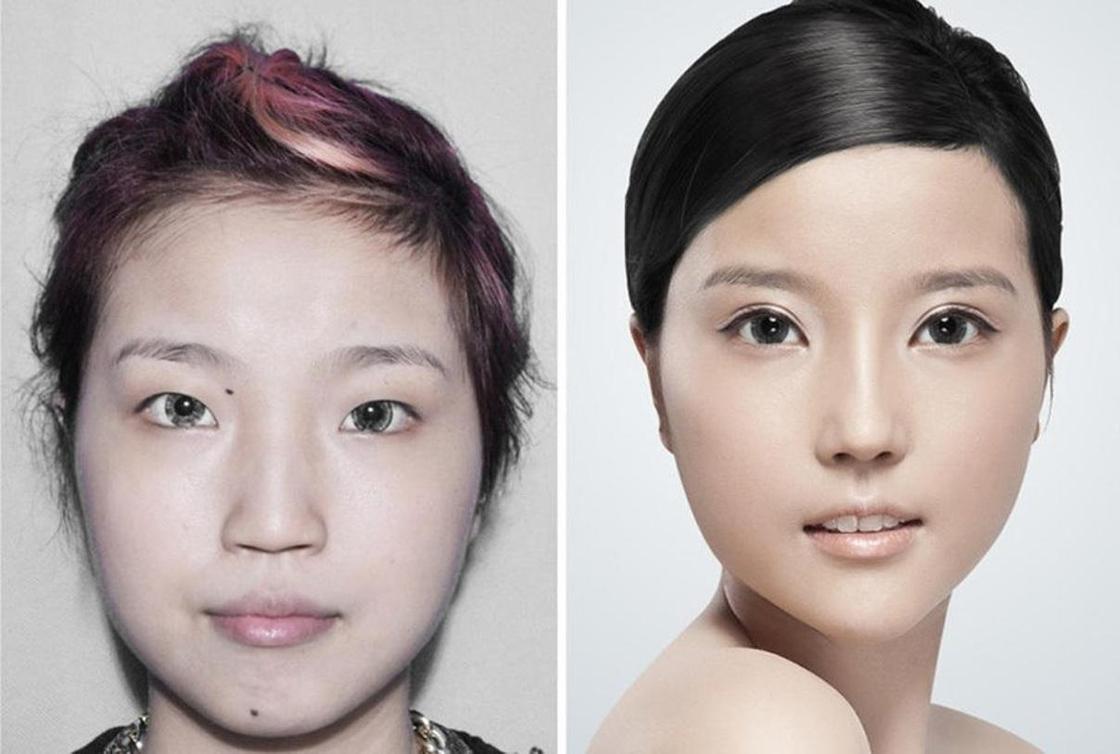 Стандарты красоты: китаянки после пластики