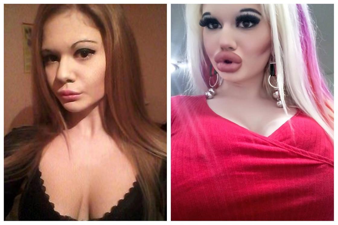 Губы-уточки, сбритые брови и взгляд буренки: студентка из Болгарии хотела стать Барби, но превратилась в бьюти-фрика