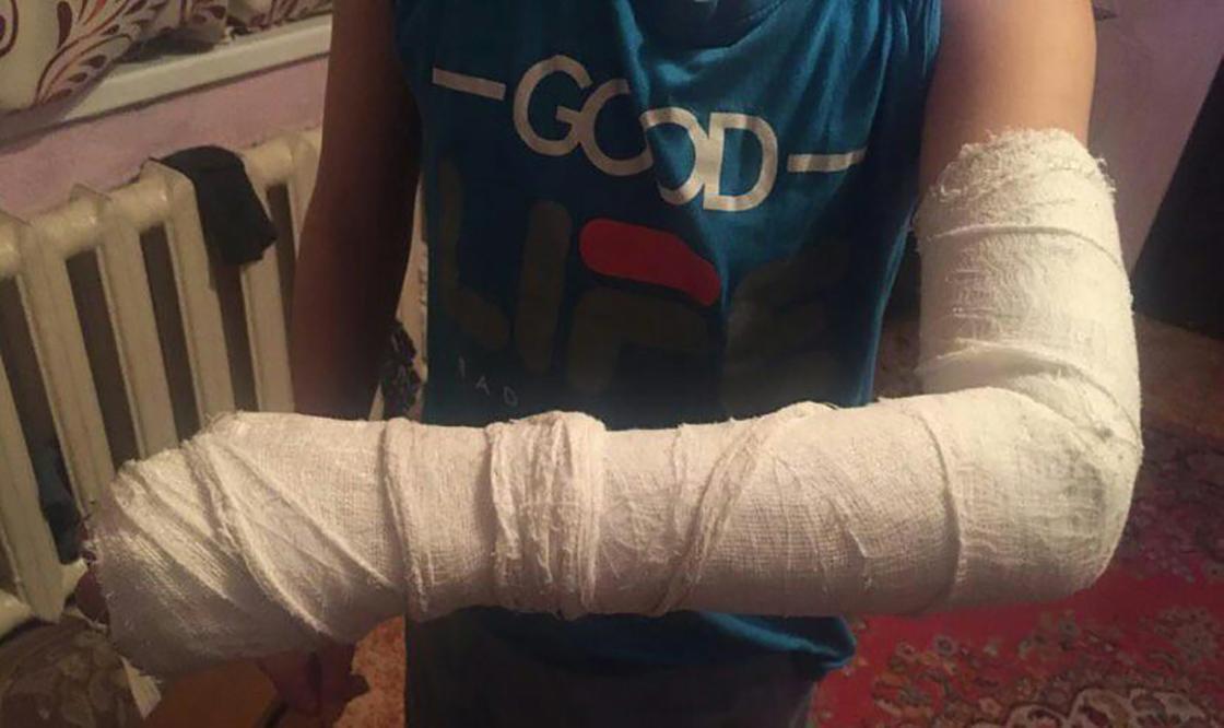 Семиклассник сломал руку сверстнику на территории школы в Карагандинской области (фото, видео)