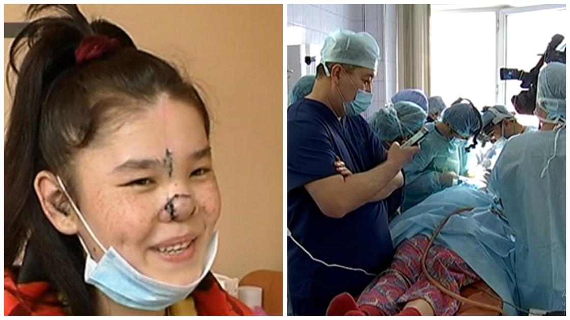 Студентке удалили образовавшуюся на лице опухоль в Алматы