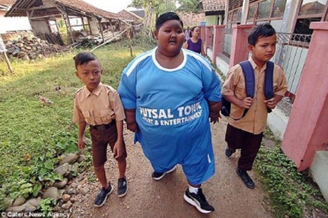 «Самый толстый мальчик в мире» похудел вдвое