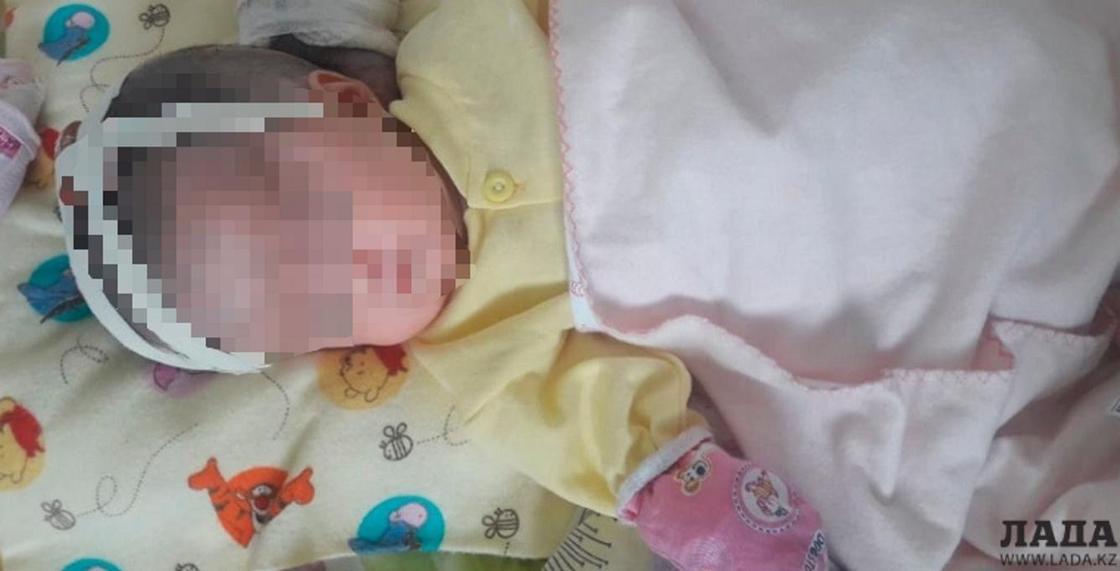 Мангистауские врачи провели сложную операцию новорожденному с мозговой грыжей