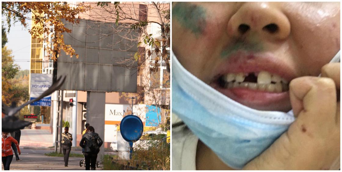 "Лицо истекало кровью": девушка заявила, что ее избил преподаватель университета "Туран"