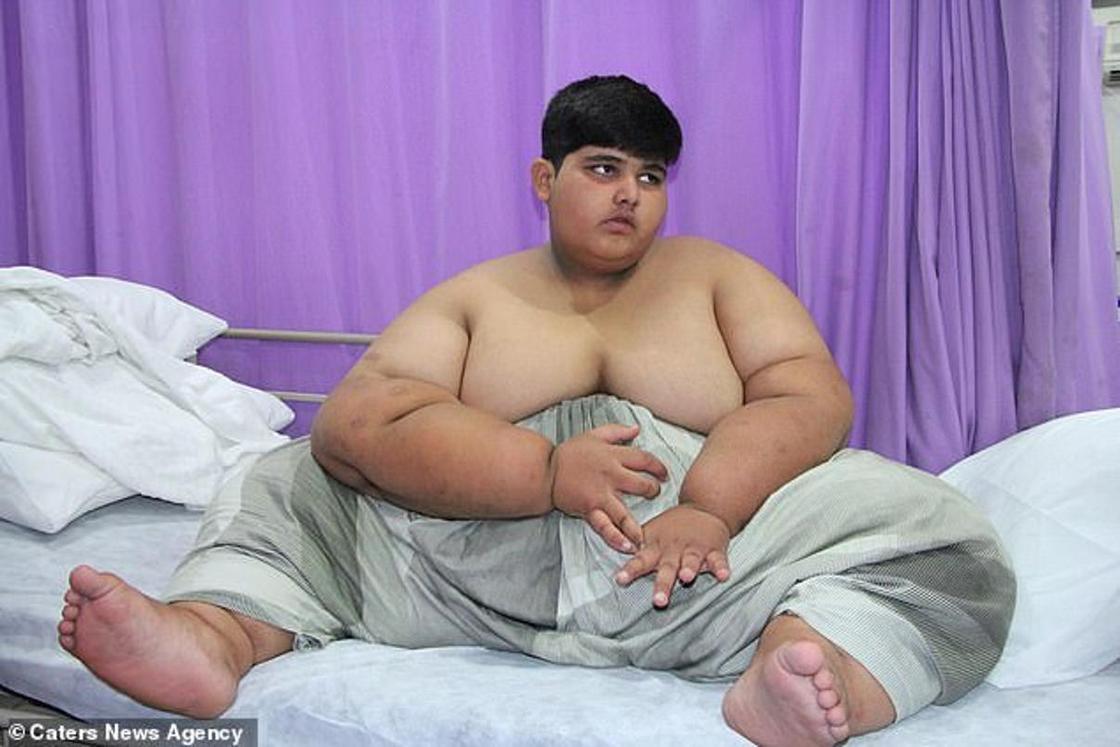 Самый толстый ребенок в мире готовится к операции