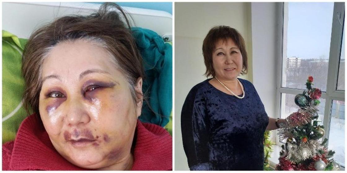 «Он пытался меня изнасиловать»: шокирующее заявление сделала избитая медсестра из Сатпаева