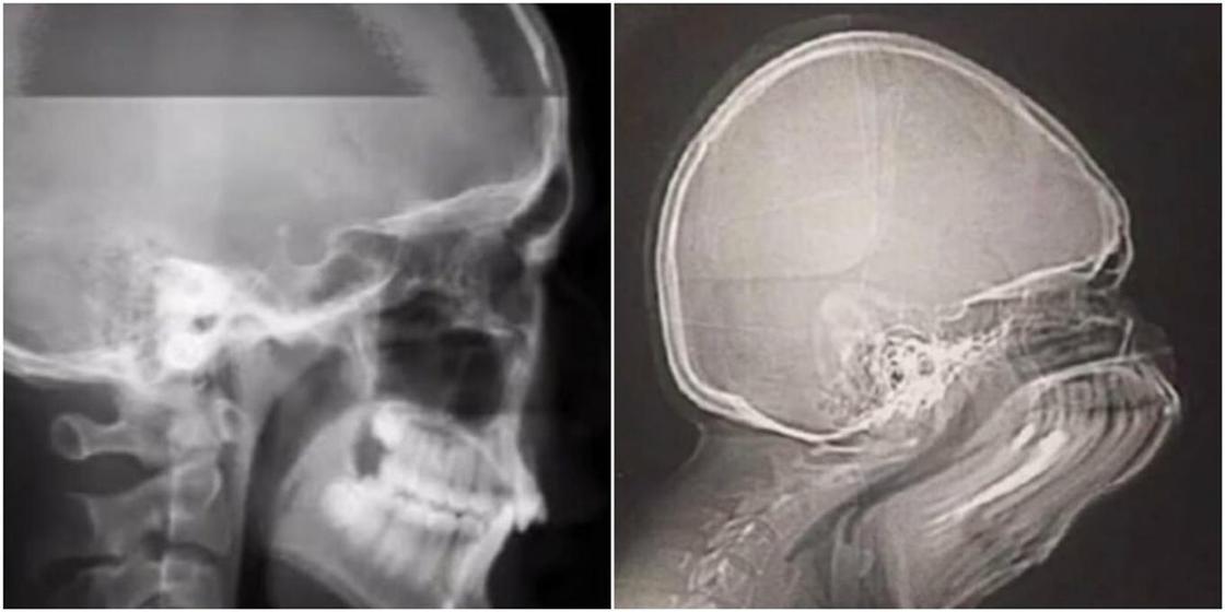 ФОТОРЕП Сердце снаружи и мозг во время чиха: 13 удивительных вещей, ломающих воображение (фото, видео) ФОТОРЕП Сердце снаружи и мозг во время чиха: 13 удивительных вещей, ломающих воображение (фото, видео)
