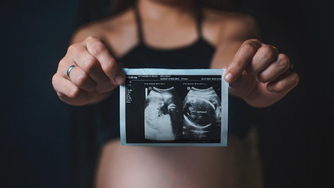 Беременная женщина держит снимок УЗИ