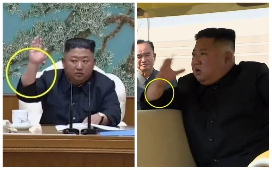 Журналистов заинтересовала точка на руке Ким Чен Ына, которой не было раньше