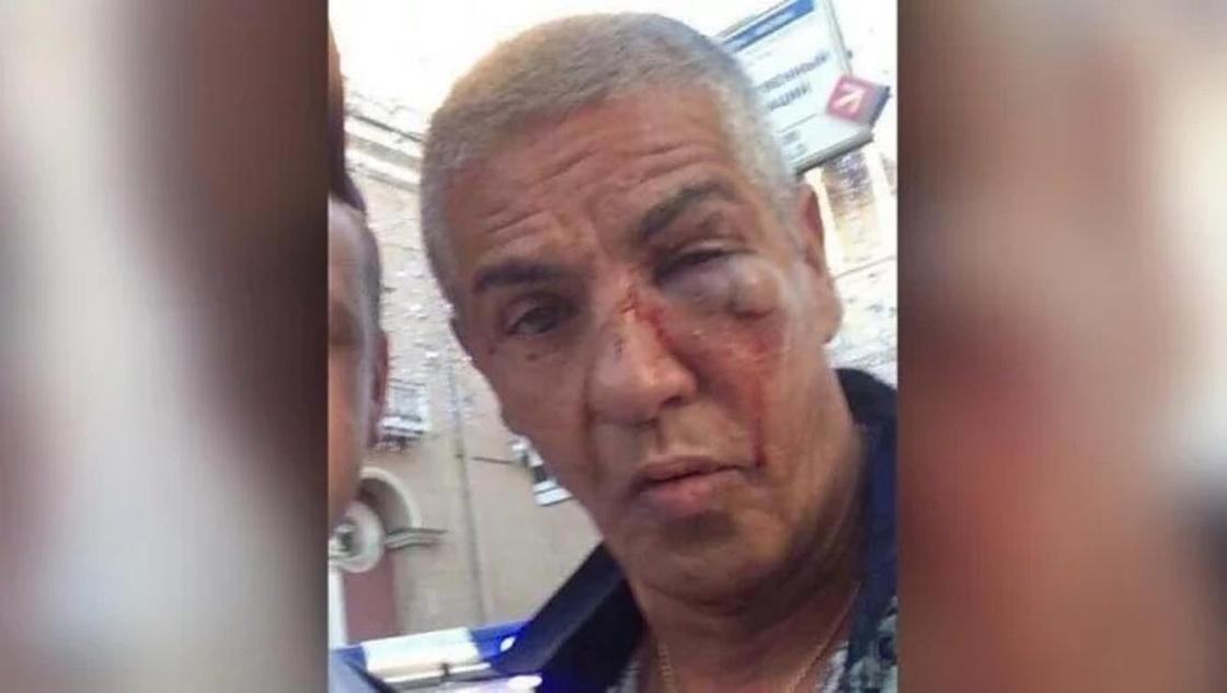 Звезду "Такси" Сами Насери выписали из больницы после избиения