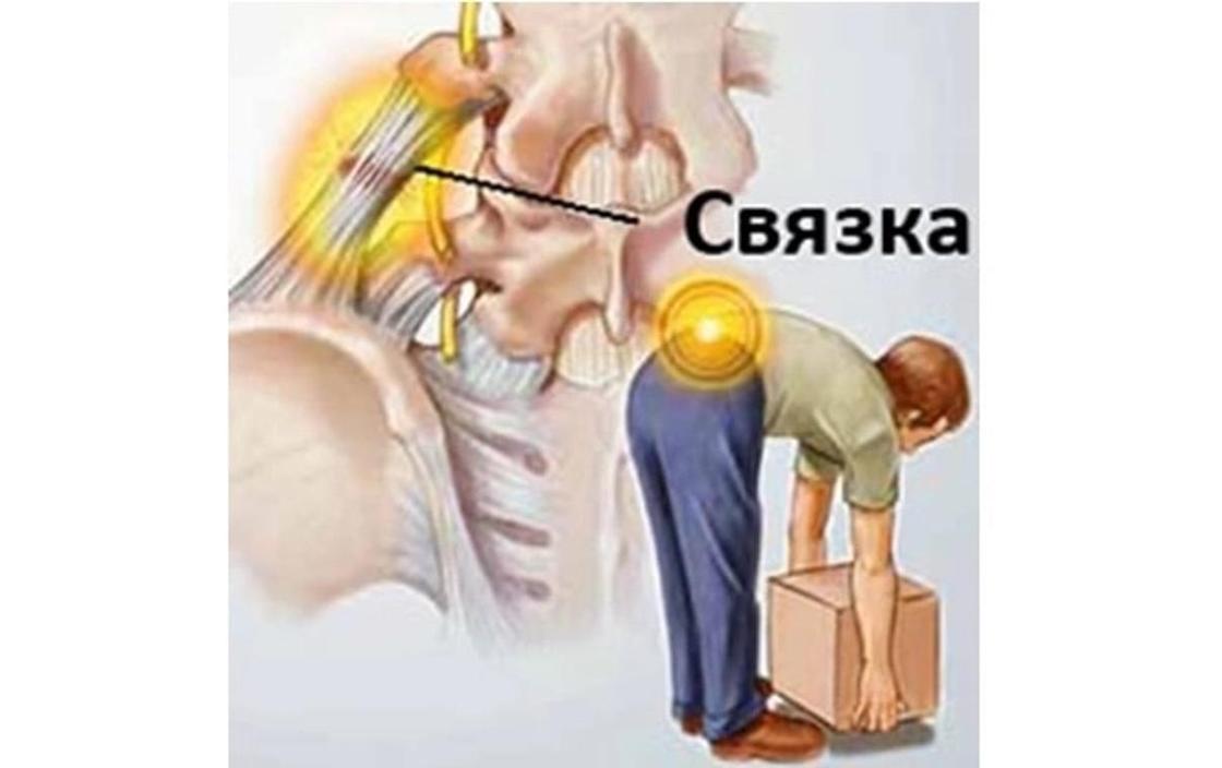 Казахстанцам рассказали, что значит «сорвать спину» и как это лечить