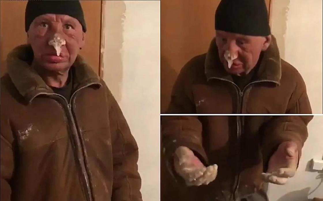 Неделя на улице: Казахстанец обморозил нос и руки до жутких льдин (видео)