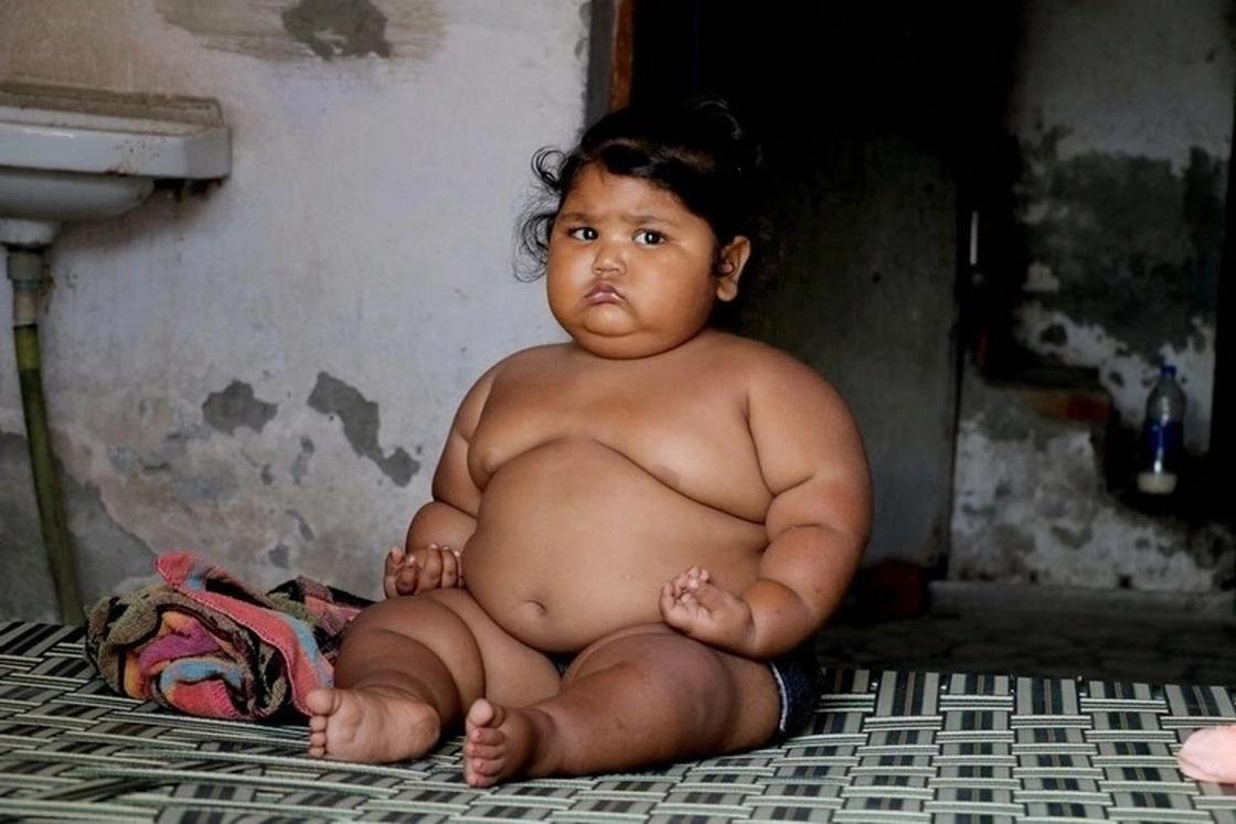 "Ест как подросток": как живет 16-месячная девочка весом в 25 килограмм (фото)